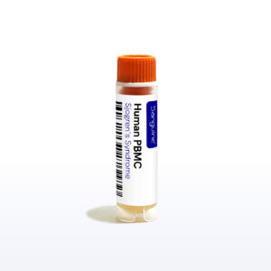 Sjogren's Syndrome PBMC