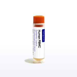 Systemic Lupus Erythematosus PBMC