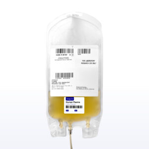 Celiac Disease Bulk Plasma - Sanguine Biosciences
