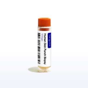 Vitiligo Skin Punch Biopsy